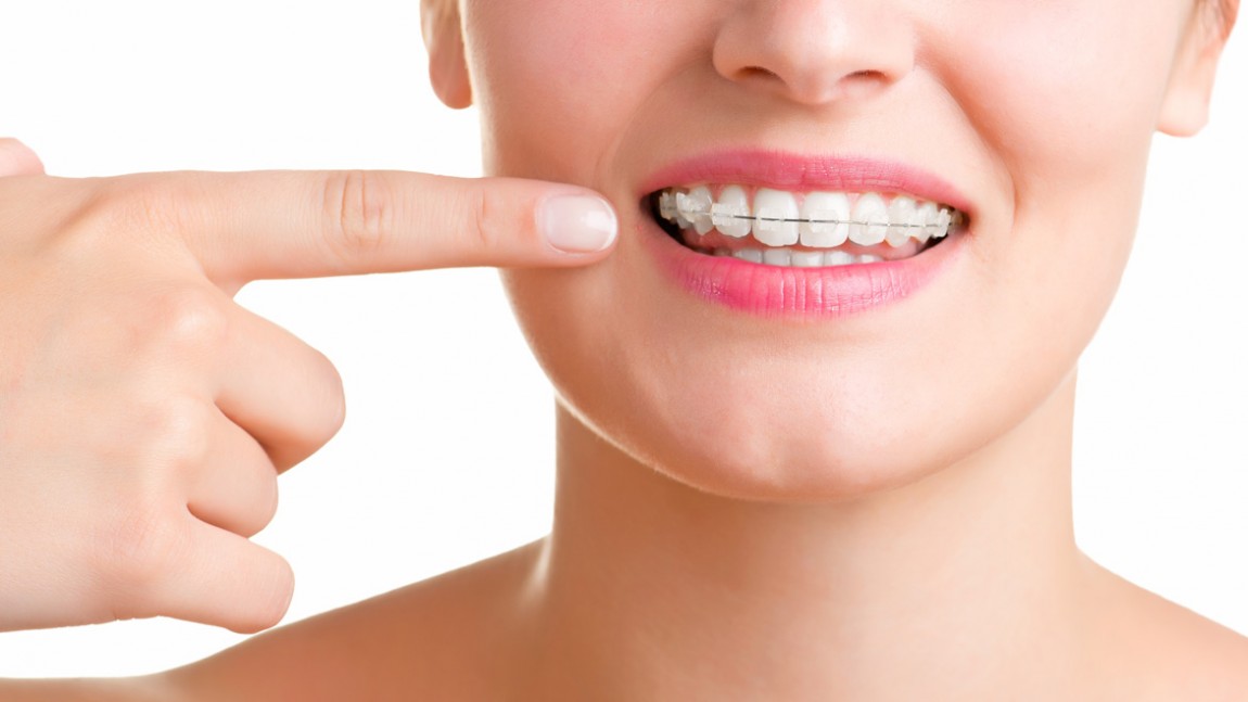 Alimentos que debes evitar si llevas ortodoncia