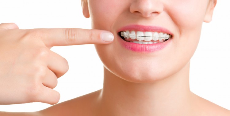 Alimentos que debes evitar si llevas ortodoncia