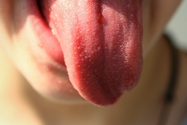 Malalties que poden afectar la teva llengua