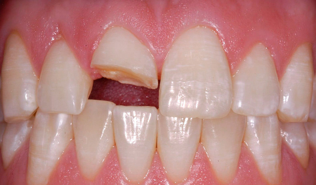 Urgencias dentales en Mollet