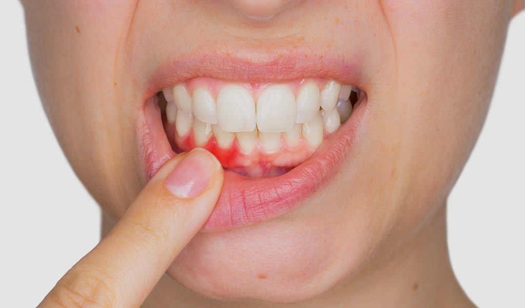Urgencias dentales en Mollet