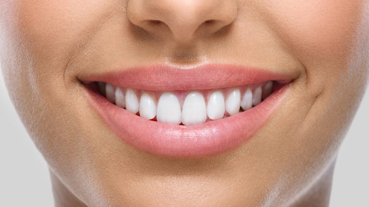 Estética dental en Mollet del Vallès