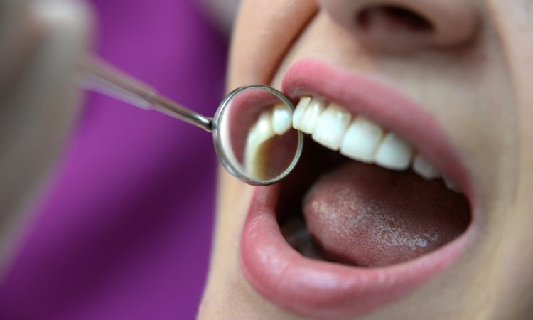 Diente por dentro: Anatomía y cuidados para mantener la salud dental